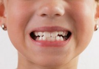 Наиболее распространенные проблеми с зубами у детей