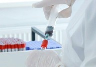 П’ять нових випадків гепатиту А виявили за добу на Вінниччині