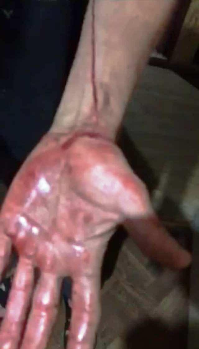 Чоловік розгулював селом з ножем після того, як порізав приятеля у Калинівській громаді (Фото)